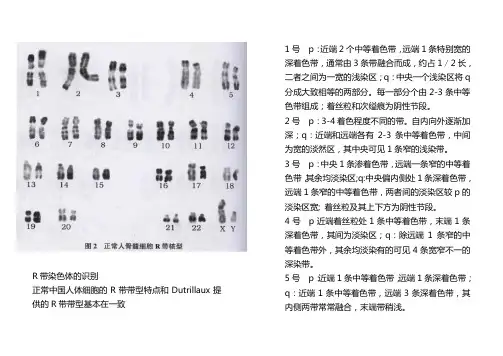 人类染色体图及各带特点(R显带)