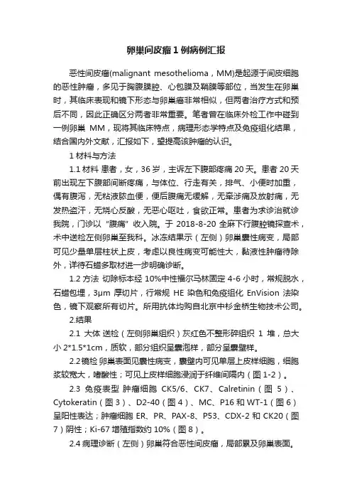 卵巢间皮瘤1例病例汇报