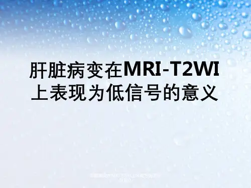 肝脏病变在MRI-T2WI上表现为低信号意义