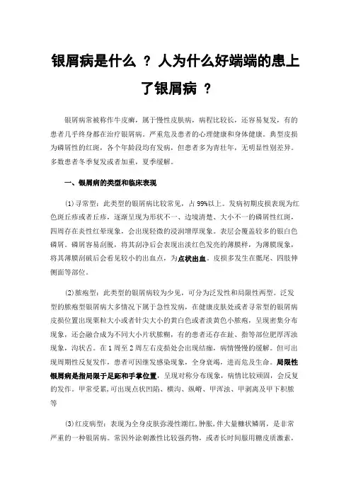 银屑病是什么?人为什么好端端的患上了银屑病?