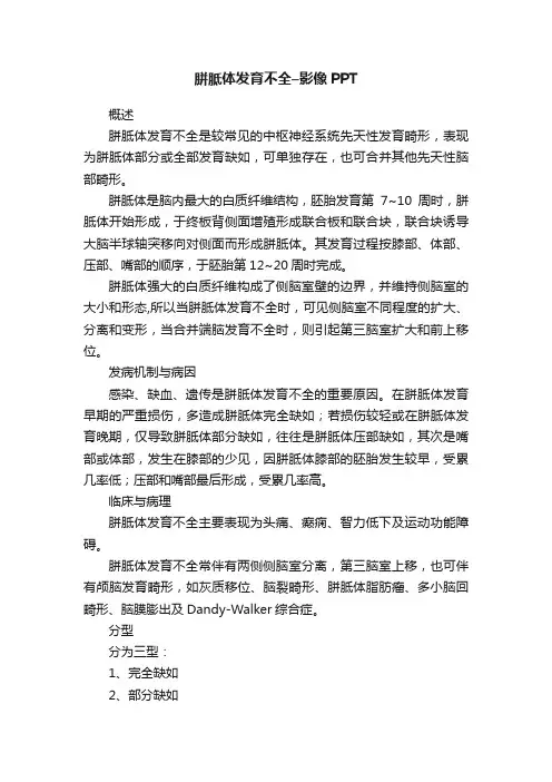 胼胝体发育不全–影像PPT