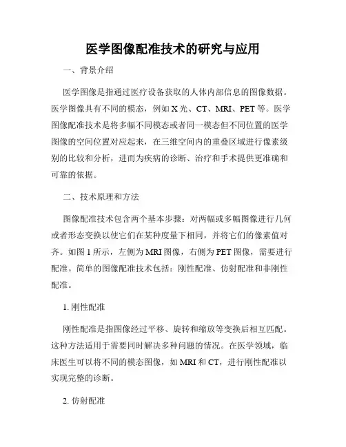 医学图像配准技术的研究与应用