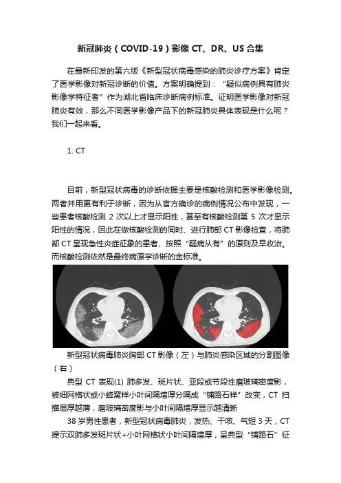 新冠肺炎（COVID-19）影像CT、DR、US合集