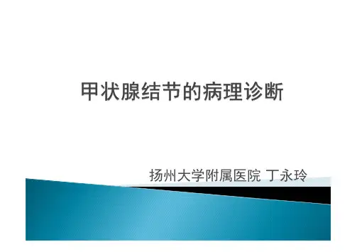 甲状腺结节的病理诊断