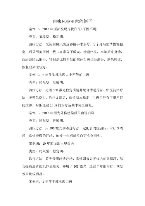 白癜风被治愈的例子