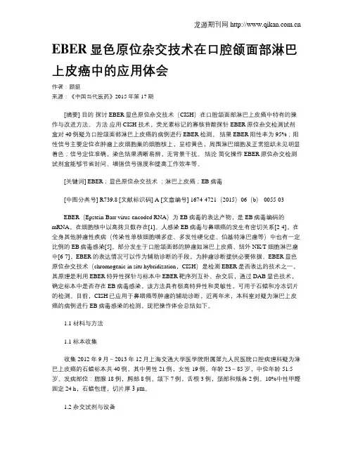 EBER显色原位杂交技术在口腔颌面部淋巴上皮癌中的应用体会