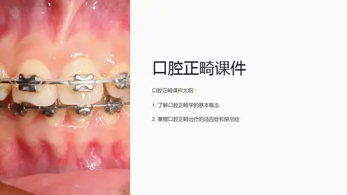 《口腔正畸课件》