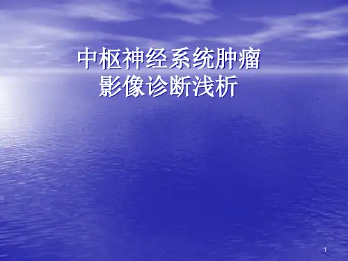 颅内肿瘤的影像诊断及鉴别诊断精品PPT课件