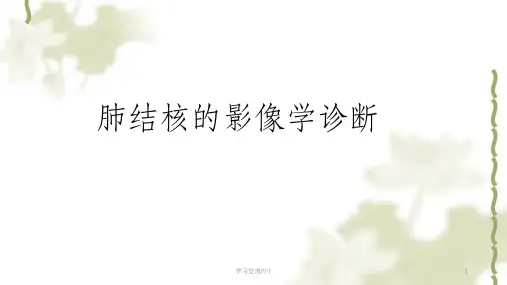 肺结核的影像学诊断课件