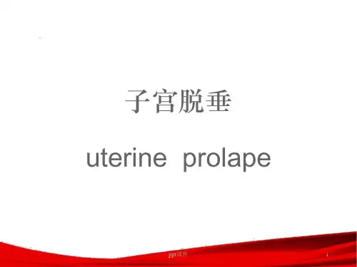 子宫脱垂--ppt课件