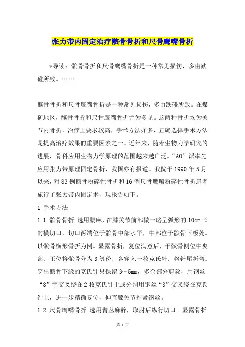 张力带内固定治疗髌骨骨折和尺骨鹰嘴骨折