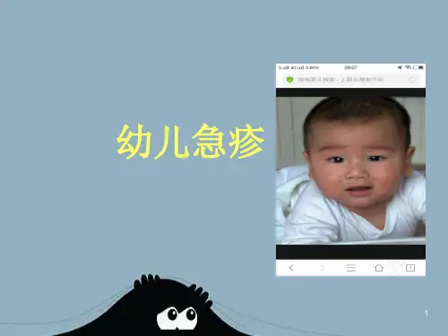 幼儿急疹治疗方案ppt课件