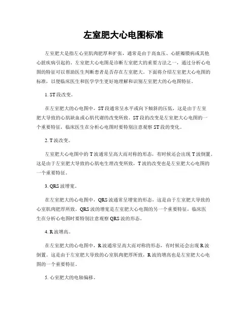 左室肥大心电图标准