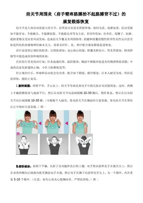 肩关节周围炎(肩手臂疼胳膊抬不起胳膊背不过)的康复锻炼恢复