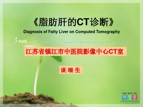 脂肪肝的CT诊断