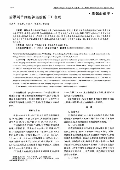 后纵隔节细胞神经瘤的CT表现