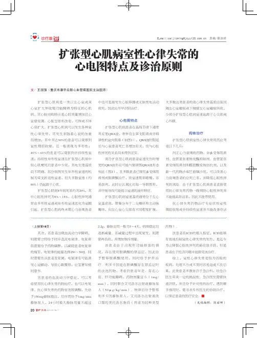 扩张型心肌病室性心律失常的心电图特点及诊治原则