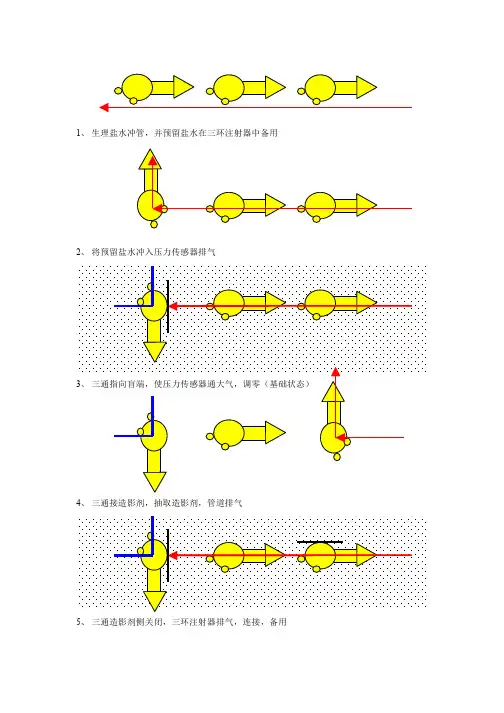 冠脉造影三联三通用法图解