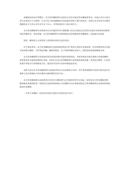 鱼鳞病如何治疗效果好