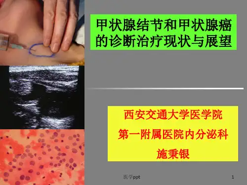 甲状腺结节和癌的诊断治疗现状与展望