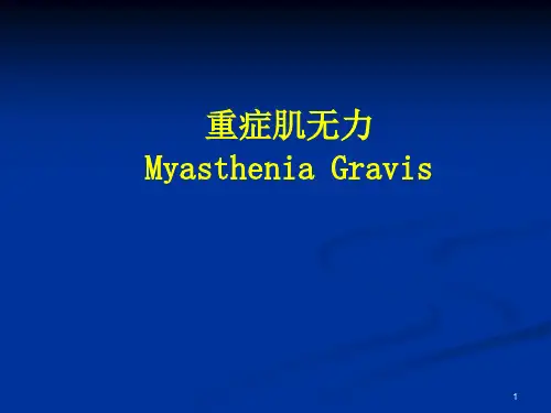 重症肌无力历史和发病机制