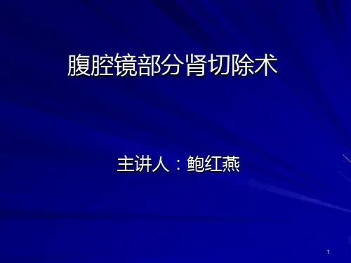 腹腔镜肾切除术 PPT课件