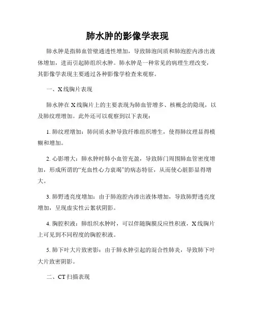 肺水肿的影像学表现