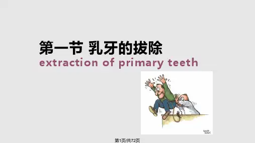 乳牙及年轻恒牙的拔除 PPT课件