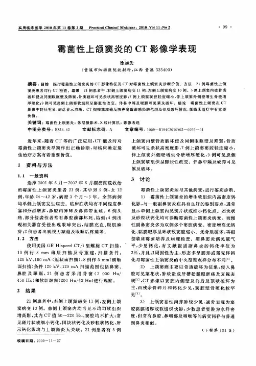 霉菌性上颌窦炎的CT影像学表现
