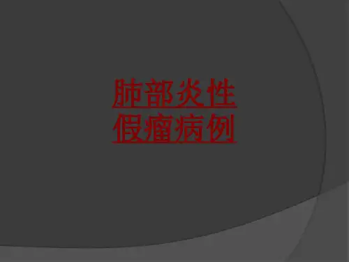 医学肺部炎性假瘤病例专题课件
