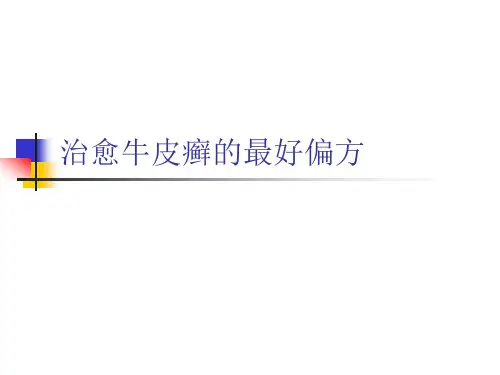 治愈牛皮癣的最好偏方