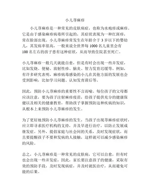 小儿荨麻疹