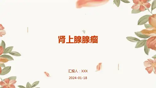 肾上腺腺瘤汇报ppt课件