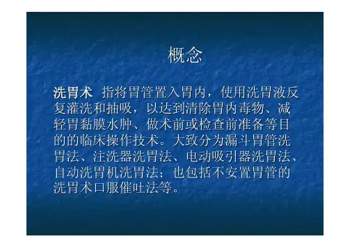 洗胃术