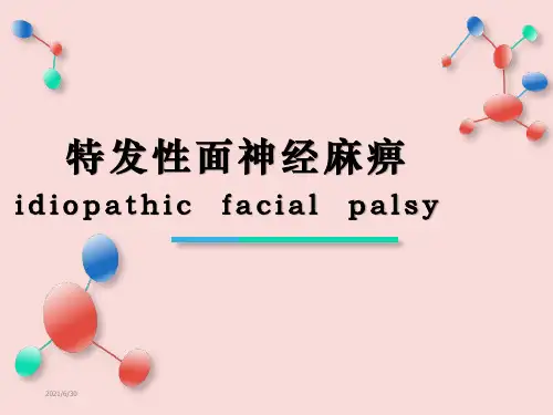 特发性面神经麻痹ppt课件