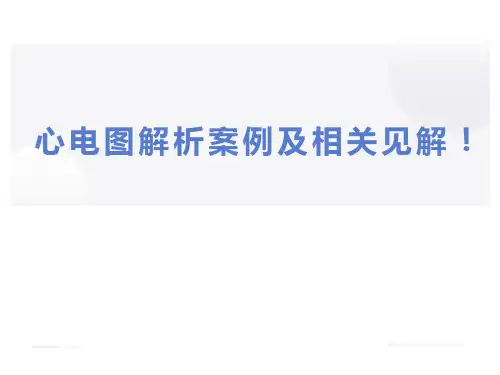 临床心电图-心电图解析案例及相关见解!