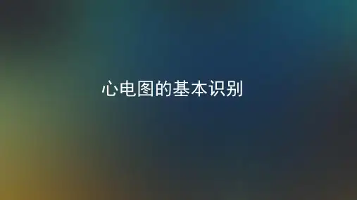 心电图的基本识别