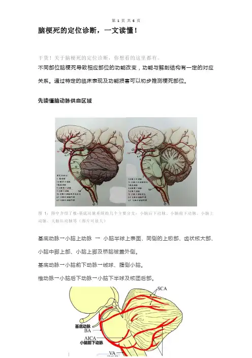 脑梗死的定位诊断,一文读懂