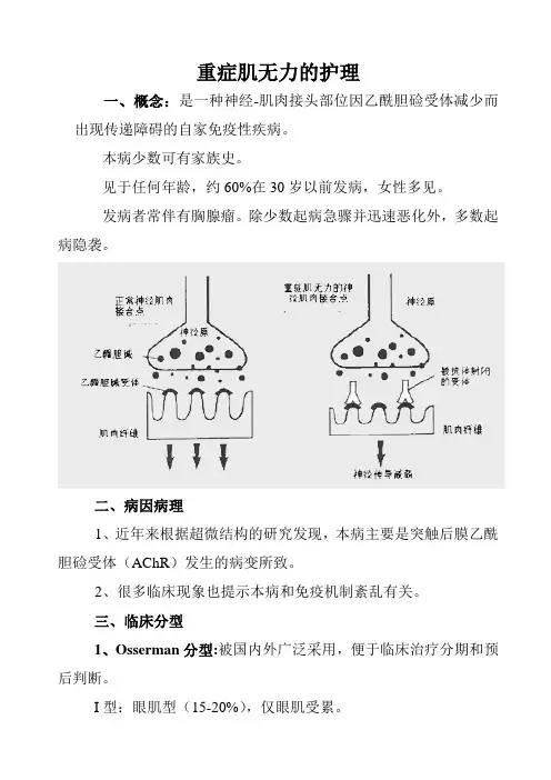 重症肌无力的护理大学论文