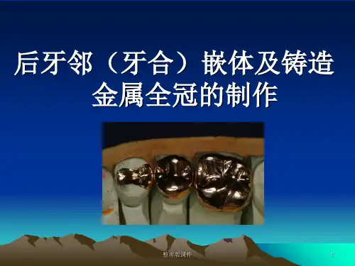 铸造金属全冠的制作PPT课件