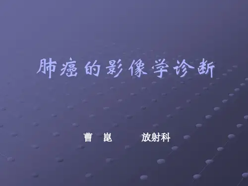 肺癌影像诊断讲课.pptx
