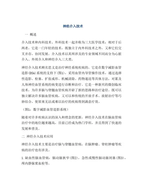 神经介入技术
