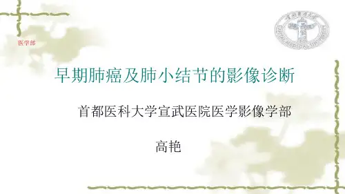 早期肺癌及肺小结节的影像诊断