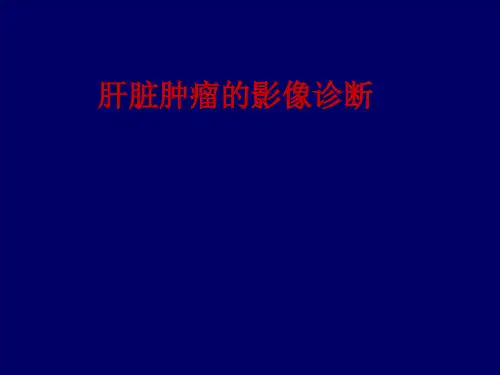 肝脏肿瘤的影像诊断及鉴别诊断(讲座)ppt模板