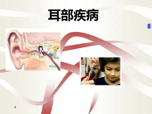 中耳炎PPT课件