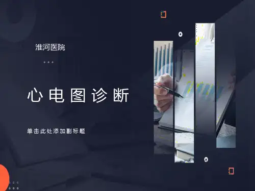 心电图-心电向量详解