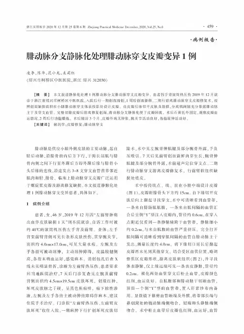 腓动脉分支静脉化处理腓动脉穿支皮瓣变异1例