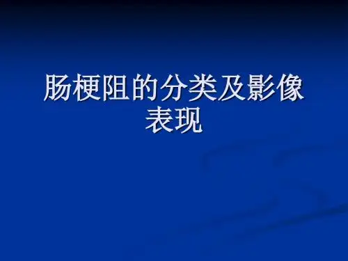 肠梗阻的分类及影像学表现分析PPT课件