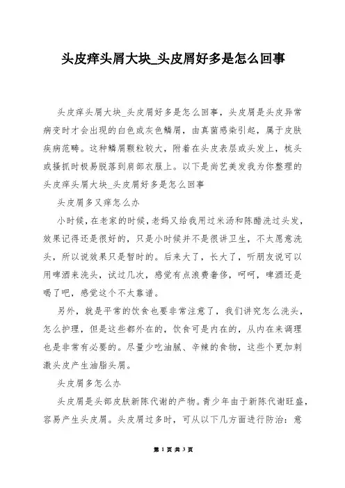 头皮痒头屑大块_头皮屑好多是怎么回事