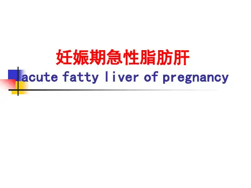 妊娠期急性脂肪肝